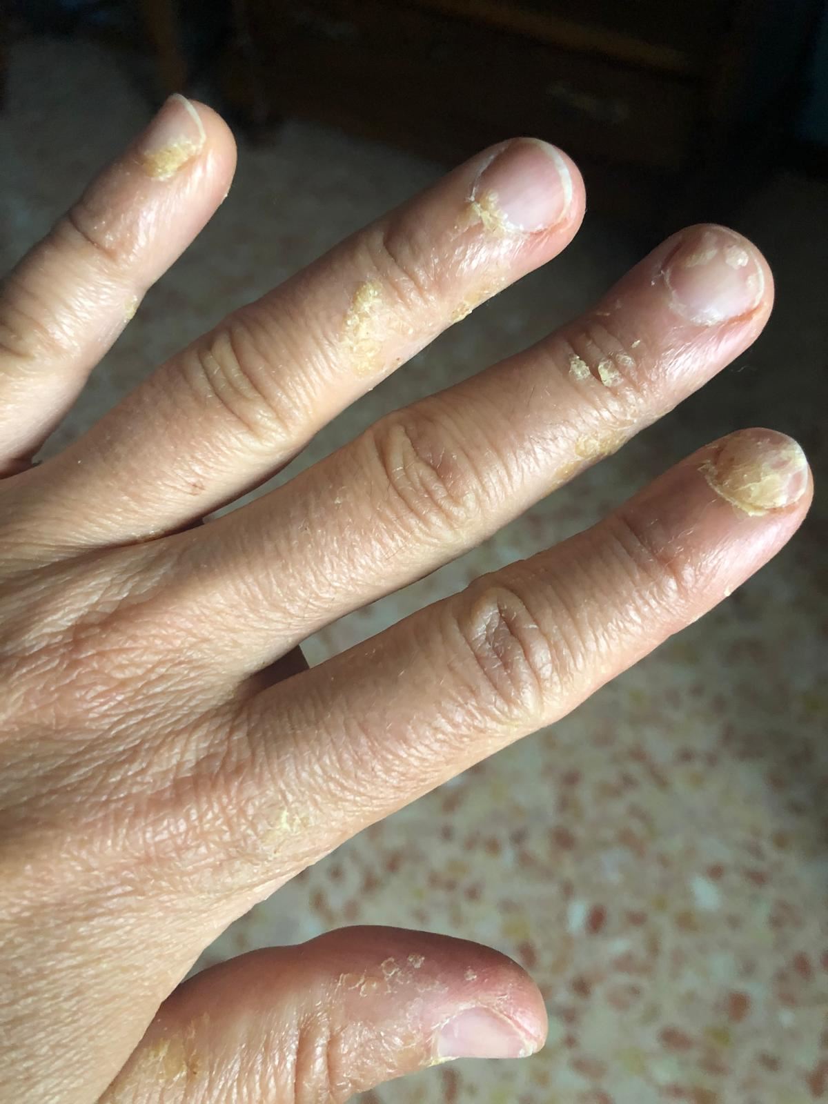 Una mano infarinata